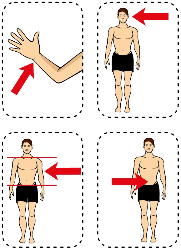 Ábra